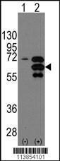 Anti-Internexin, alpha Rabbit Polyclonal Antibody (Biotin)