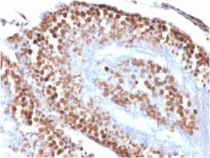 Immunohistochemical analysis of formalin-fixed, paraffin-embedded rat testis using Anti-Wilms tumor Protein Antibody [rWT1/857]