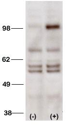 Anti-PI3KC3 Rabbit Polyclonal Antibody