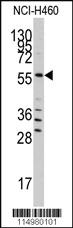 Anti-SARS Rabbit Polyclonal Antibody