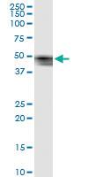 Anti-SERPINB7 Rabbit Polyclonal Antibody