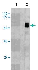 Anti-PRF1 Mouse Monoclonal Antibody [clone: CE2.10]