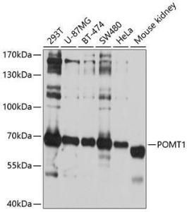 Anti-POMT1 Antibody (A11276)