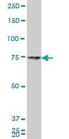 Anti-HNRNPM Mouse Monoclonal Antibody [clone: 2B6]