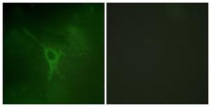 Antibody anti-GFAP phospho SER38 100 µg