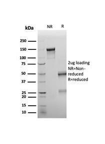 SDS-PAGE analysis of Anti-Wilms Tumor Protein Antibody [rWT1/6908] under non-reduced and reduced conditions; showing intact IgG and intact heavy and light chains, respectively. SDS-PAGE analysis confirms the integrity and purity of the antibody