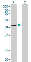 Anti-CYP2C8 Rabbit Polyclonal Antibody