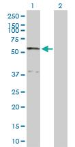 Anti-SERPINA10 Rabbit Polyclonal Antibody