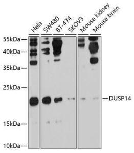 Western blot analysis of extracts of various cell lines, using Anti-DUSP14 Antibody (A11277) at 1:1,000 dilution