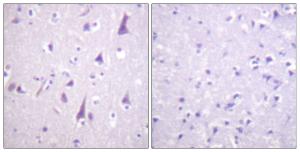 Antibody anti-GFAP phospho SER38 100 µg