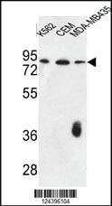 Anti-F12 Rabbit Polyclonal Antibody