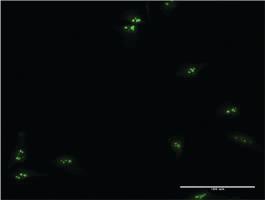 Anti-TCEA1 Mouse Monoclonal Antibody [clone: 1B7]