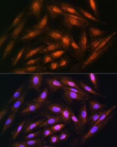 Immunofluorescence analysis of H9C2 cells using Anti-DUSP14 Antibody (A11277) at a dilution of 1:100. DAPI was used to stain the cell nuclei (blue)