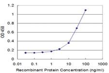 Anti-HNRNPM Mouse Monoclonal Antibody [clone: 2B6]