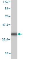 Anti-CHST3 Mouse Monoclonal Antibody [clone: 1C4]