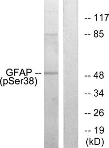 Antibody anti-GFAP phospho SER38 100 µg