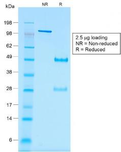 SDS-PAGE analysis of Anti-Wilms Tumor Protein Antibody [rWT1/857] under non-reduced and reduced conditions; showing intact IgG and intact heavy and light chains, respectively. SDS-PAGE analysis confirms the integrity and purity of the Antibody