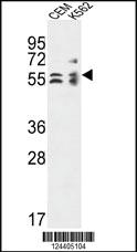 Anti-TBCE Rabbit Polyclonal Antibody