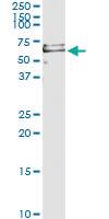 Anti-PRF1 Antibody Pair