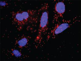 Anti-IKBKB + CTNNB1 Antibody Pair