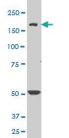 Anti-SCN8A Mouse Monoclonal Antibody [clone: 4G7]