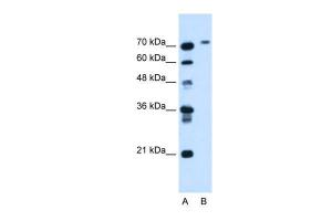 Anti-BCHE Rabbit Polyclonal Antibody