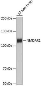 Western blot analysis of extracts of Mouse brain, using Anti-NMDAR1 Antibody [ARC0684] (A308794) at 1:1,000 dilution. The secondary antibody was Goat Anti-Rabbit IgG H&L Antibody (HRP) at 1:10,000 dilution.