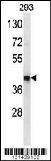 Anti-OR10J3 Rabbit Polyclonal Antibody (HRP (Horseradish Peroxidase))