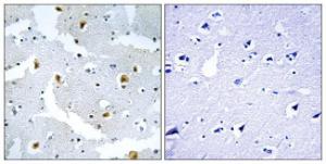 Immunohistochemical analysis of paraffin-embedded human brain tissue using Anti-FMN2 Antibody The right hand panel represents a negative control, where the antibody was pre-incubated with the immunising peptide