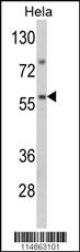 Anti-HSF1 Rabbit Polyclonal Antibody