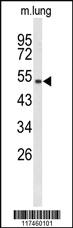 Anti-PSMD10 Rabbit Polyclonal Antibody