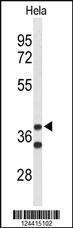 Anti-SLC45A3 Rabbit Polyclonal Antibody