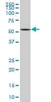 Anti-CYP2D6 Mouse Monoclonal Antibody [clone: 2C5]