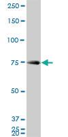 Anti-HNRNPM Mouse Monoclonal Antibody [clone: 3F7]