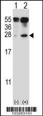 Anti-IL27 Rabbit Polyclonal Antibody (APC (Allophycocyanin))