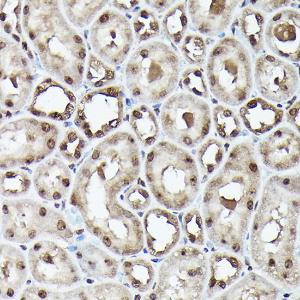 Immunohistochemistry analysis of paraffin-embedded rat kidney using Anti-Ubiquitin Antibody [ARC50024] (A307666) at a dilution of 1:100 (40X lens). Perform high pressure antigen retrieval with 10 mM citrate buffer pH 6.0 before commencing with IHC staining protocol