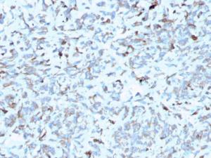 Immunohistochemical analysis of formalin-fixed, paraffin-embedded human kidney using Anti-C1QA Antibody [C1QA/2952]