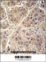 Anti-HSF1 Rabbit Polyclonal Antibody