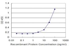 Anti-CYP2D6 Mouse Monoclonal Antibody [clone: 2C5]