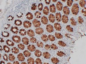 Immunohistochemical analysis of paraffin-embedded human Colon using Anti-MUC2 Antibody