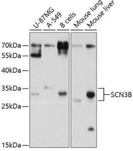 Western blot analysis of extracts of various cell lines, using Anti-SCN3B Antibody (A11284) at 1:1000 dilution