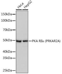 Western blot analysis of extracts of various cell lines, using Anti-PKA R2/PKR2 Antibody [ARC0860] (A308795) at 1:1,000 dilution The secondary antibody was Goat Anti-Rabbit IgG H&L Antibody (HRP) at 1:10,000 dilution Lysates/proteins were present at 25 µg per lane