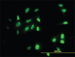 Anti-RAD18 Mouse Monoclonal Antibody [clone: 3H7]