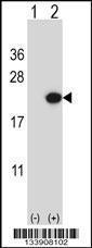 Anti-EDN2 Rabbit Polyclonal Antibody (HRP (Horseradish Peroxidase))