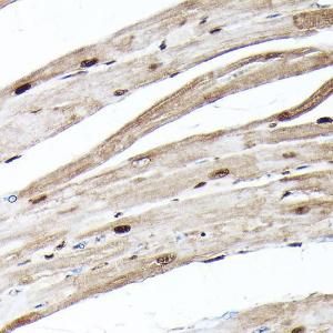 Immunohistochemistry analysis of paraffin-embedded rat heart using Anti-Ubiquitin Antibody [ARC50024] (A307666) at a dilution of 1:100 (40X lens). Perform high pressure antigen retrieval with 10 mM citrate buffer pH 6.0 before commencing with IHC staining protocol