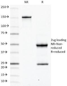 SDS-PAGE analysis of Anti-CD79a Antibody [JCB117] under non-reduced and reduced conditions; showing intact IgG and intact heavy and light chains, respectively. SDS-PAGE analysis confirms the integrity and purity of the antibody