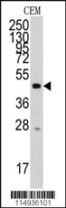 Anti-YARS2 Rabbit Polyclonal Antibody