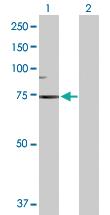 Anti-SCNN1B Rabbit Polyclonal Antibody