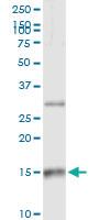 Anti-CCL21 Polyclonal Antibody Pair