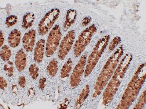 Immunohistochemical analysis of paraffin-embedded human Colon using Anti-MUC2 Antibody